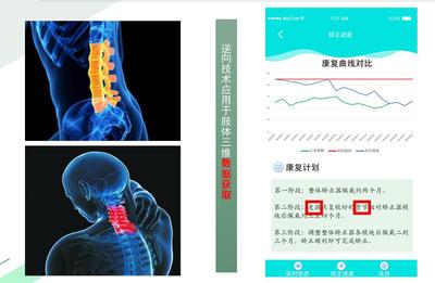 时时正-更有效、更智能、更安心的专业脊柱矫正器械引领着