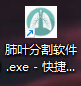 肺叶分割软件