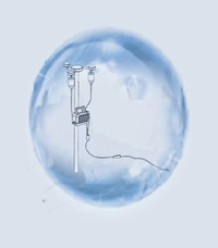 “袋”有乾坤-新型智慧输液